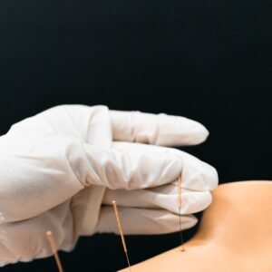 Close-up of a gloved hand performing acupuncture on a model arm with fine needles.