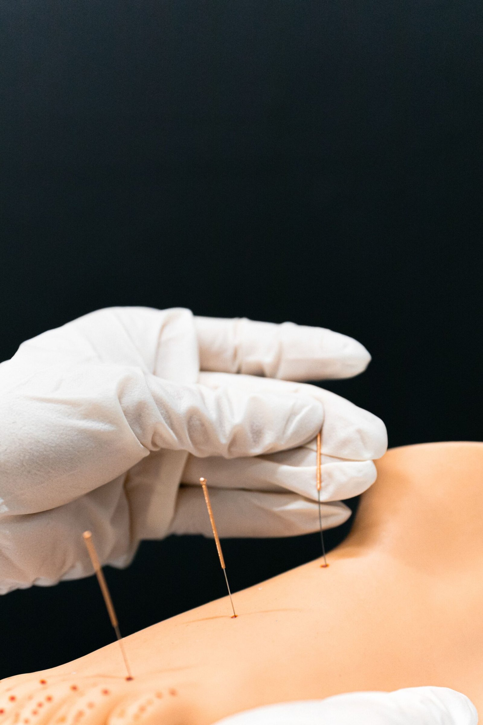 pexels photo 6094082 6094082 Close-up of a gloved hand performing acupuncture on a model arm with fine needles.